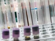 Coronavirus PCR Test Labor