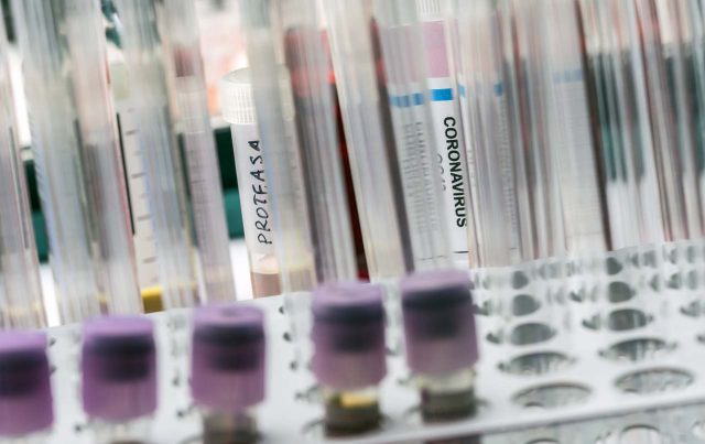 Coronavirus PCR Test Labor